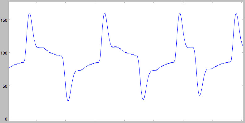 filtered signal 1MS